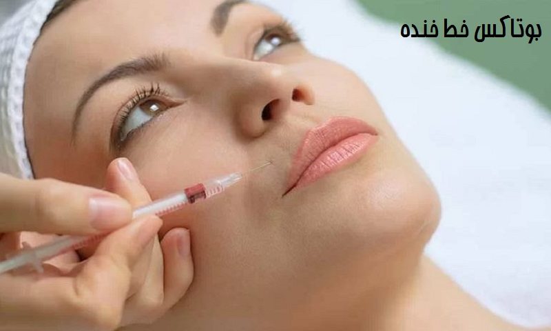 بوتاکس خط خنده - جواسازی صورت